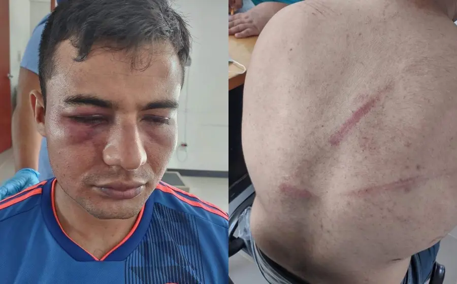 golpeado
