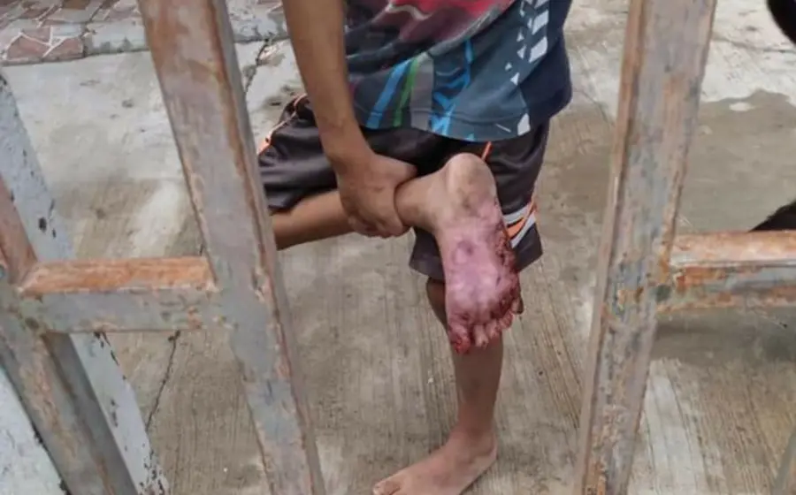Los niños presentan alto grado de desnutrición, deshidratación y diversas lesiones.