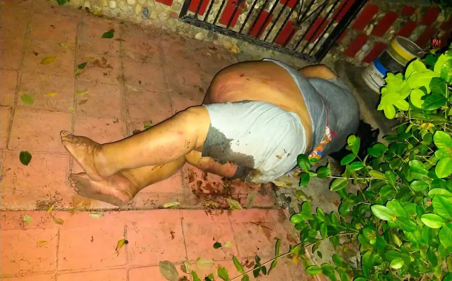 Mujer se resbala y sufre lesiones
