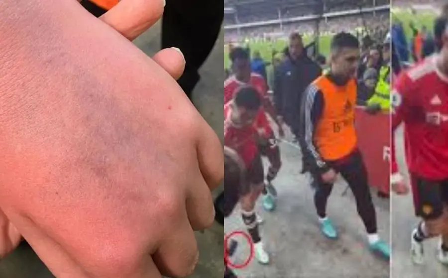 Cristiano Ronaldo agrede a fan 