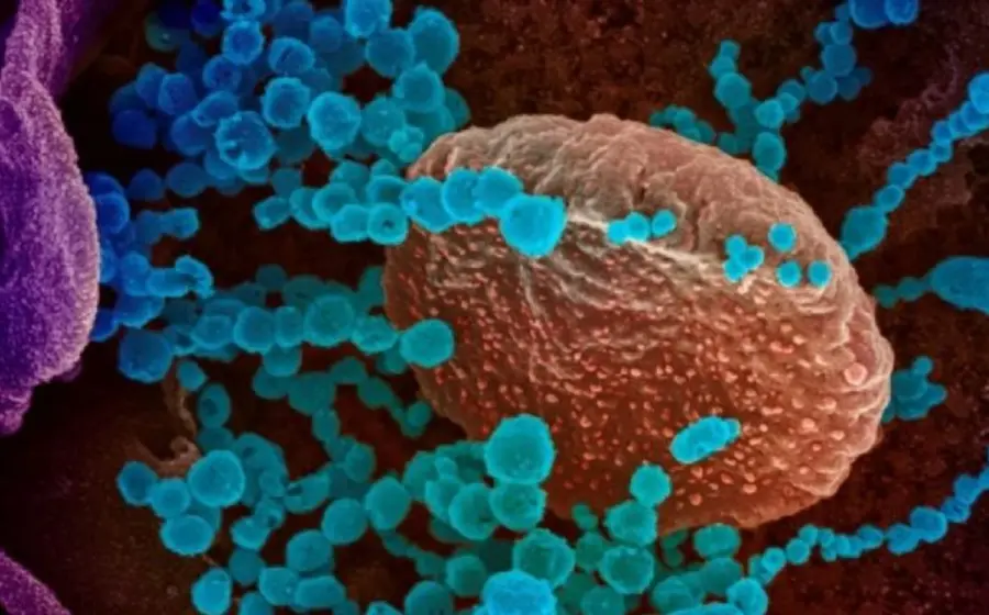 Virus