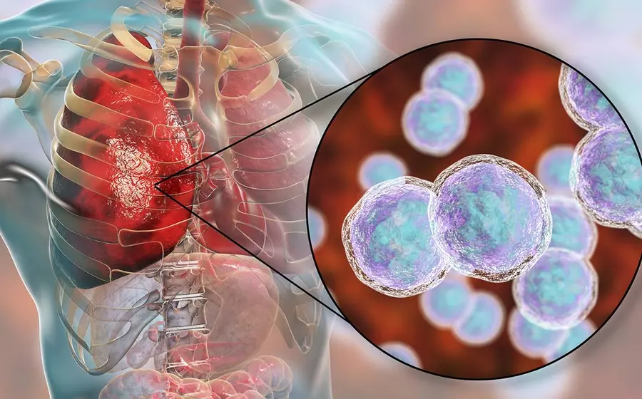 bacterias
