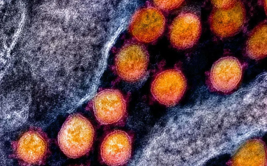 bacteria_om_85