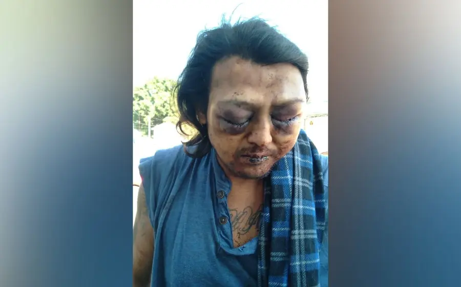 Golpeado en la central