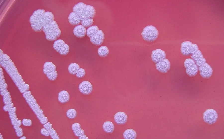 bacteria 