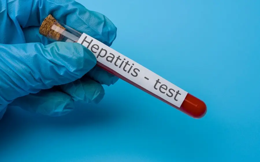 test_hepatitis