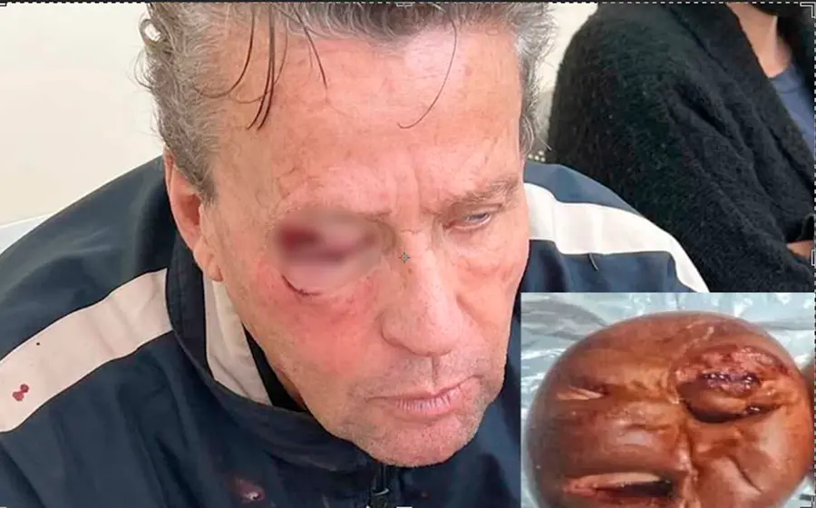 pan_alfredo_adame_ golpeado