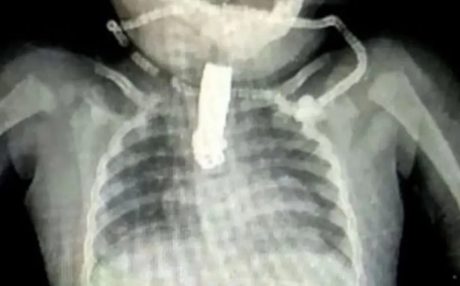 radiografia