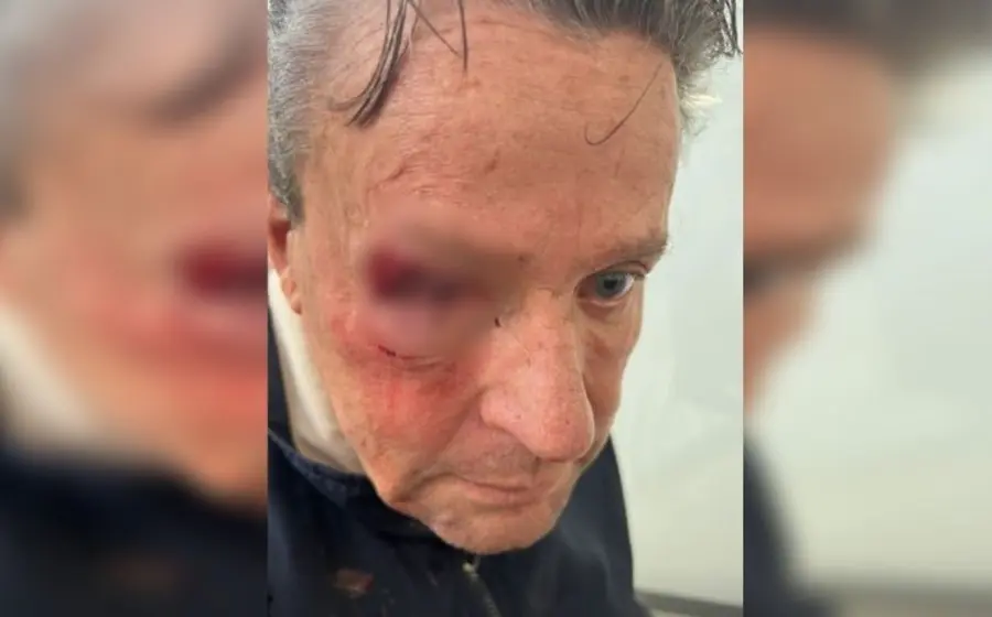 Nueva golpiza a Alfredo Adame
