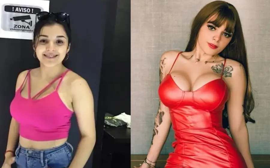 Cirugías estéticas de Karely Ruiz 