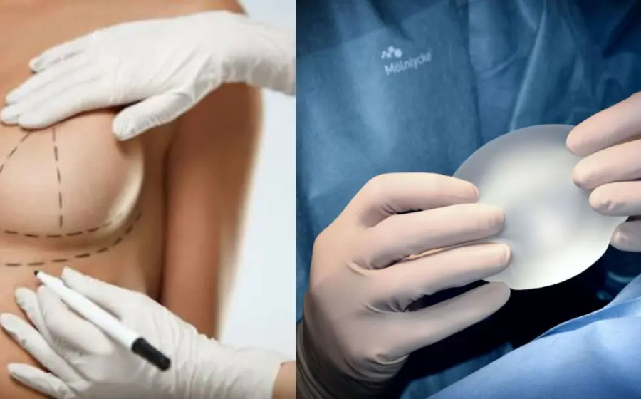implantes-senos