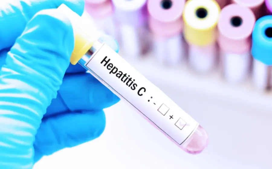 hepatitis-oaxaca