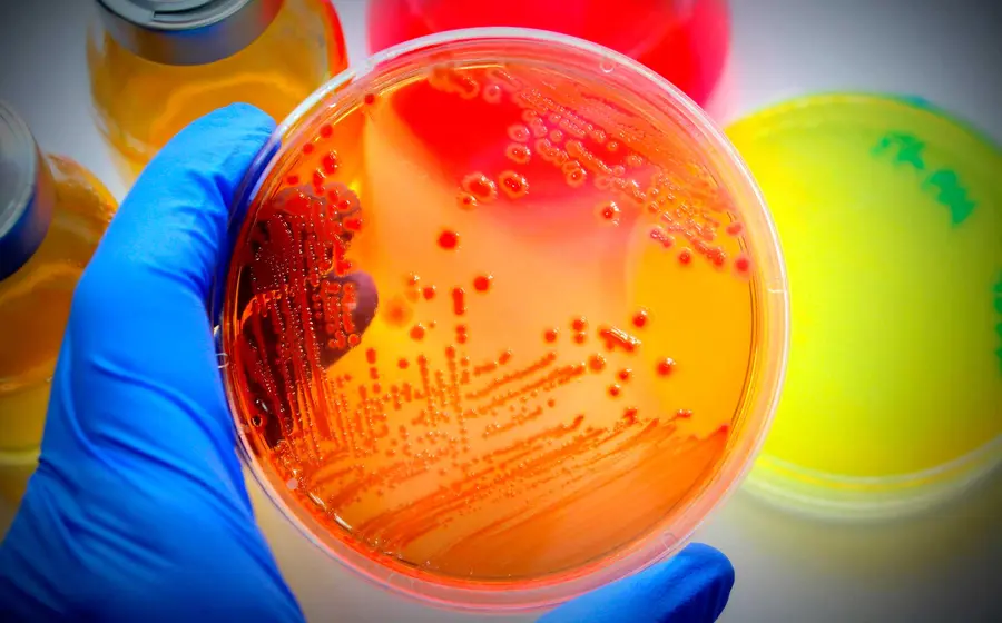 bacterias 