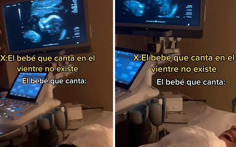ultrasonido 