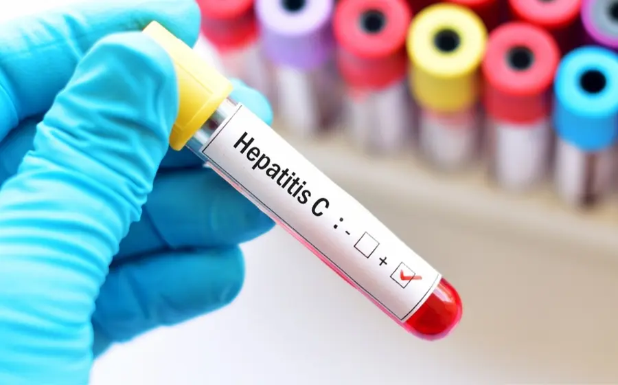 hepatitis-prueba