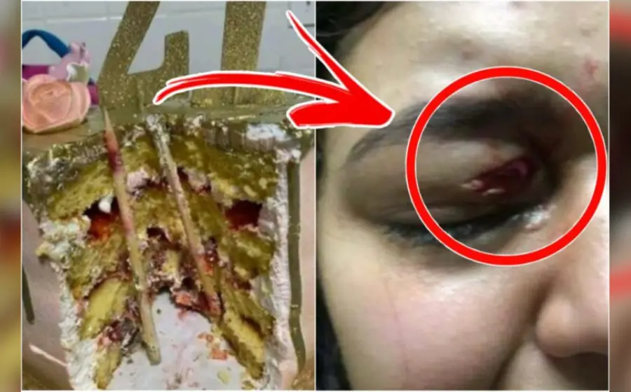 cumpleañera_casi_pierde_ojo