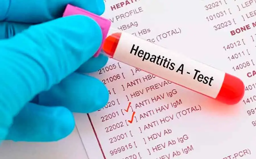 hepatitis 