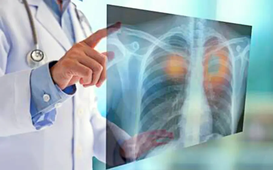 salud-pulmones-doctor