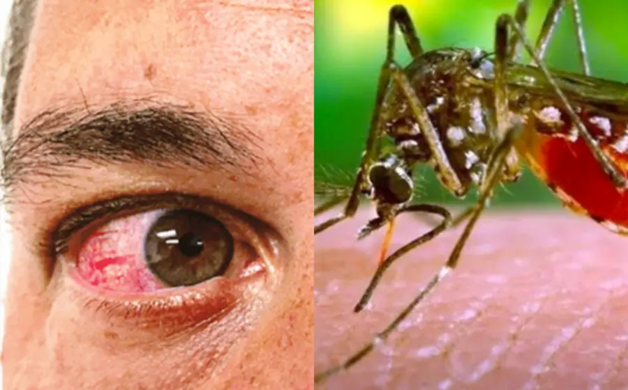 portada-zika