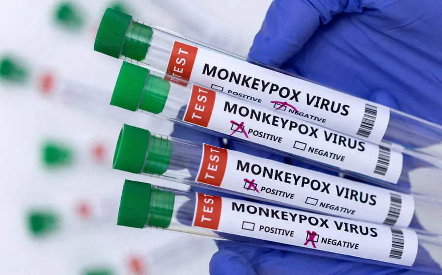 monkeypox-virus
