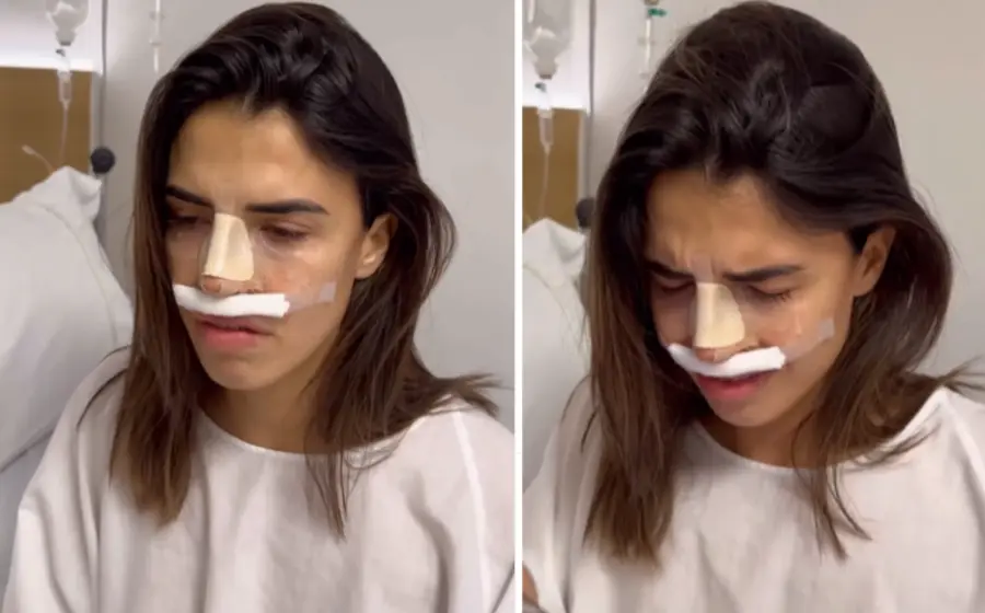 influencer_se_queja_de_rinoplastia