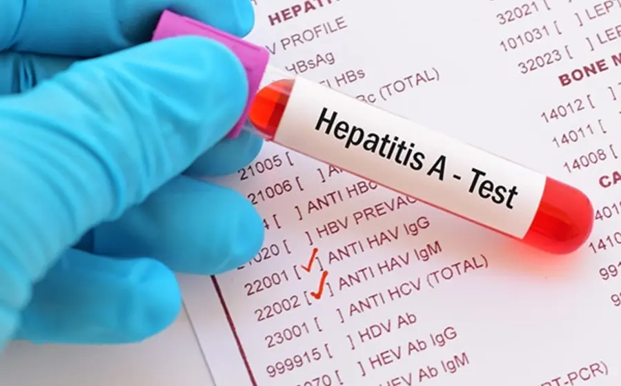 hepatitis-a