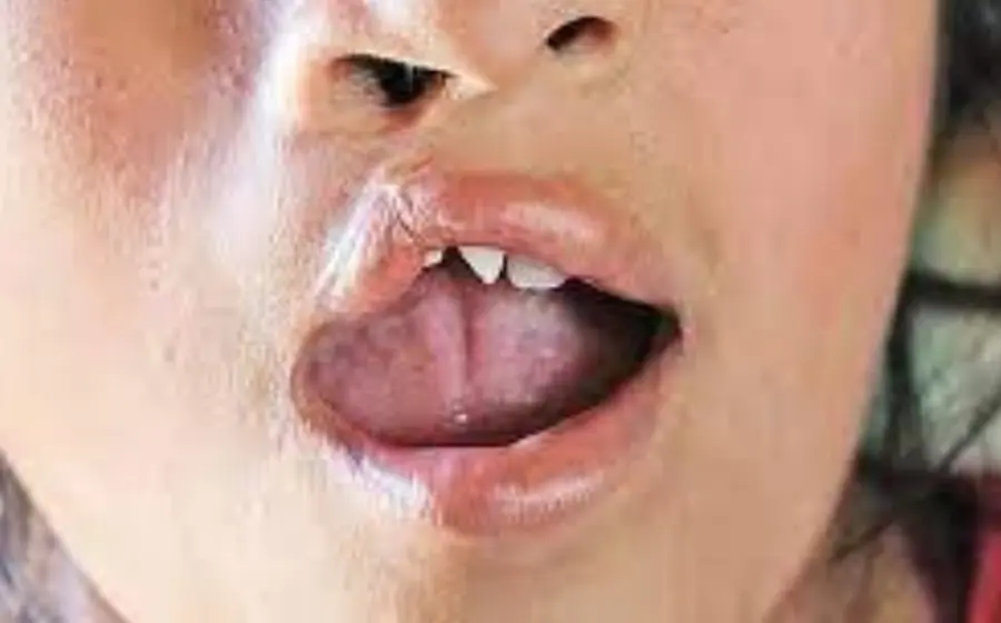 labios-oaxaca