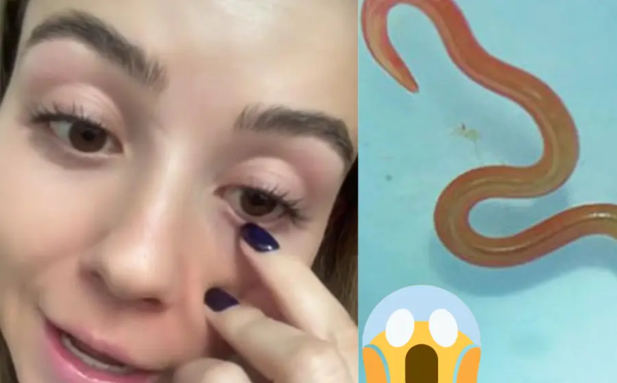 mujer_tenia_gusano_en_ojo
