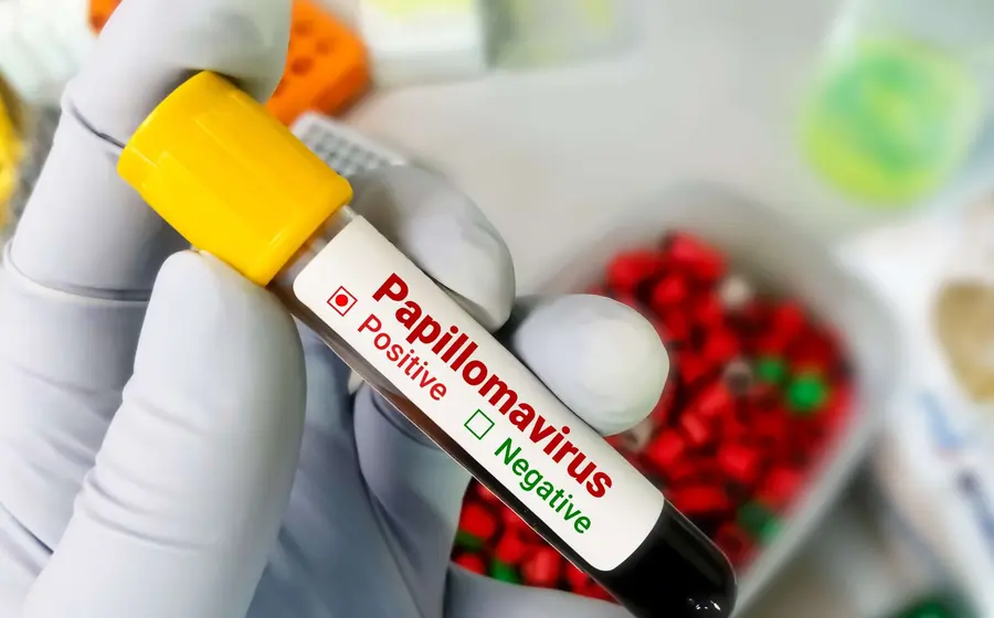 portada-papiloma