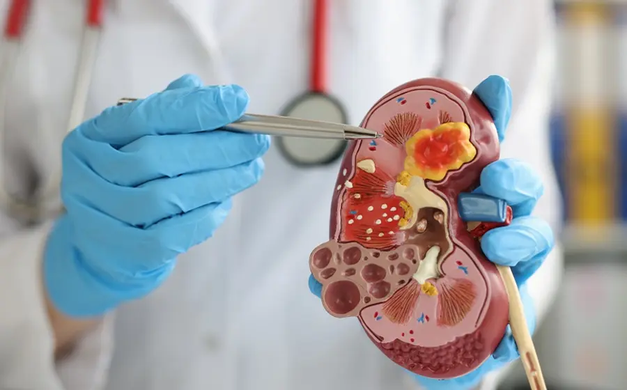 Los riñones cumplen con la función renal de filtrar  la sangre, eliminar desechos y mantener el equilibrio de sustancias químicas en el cuerpo.