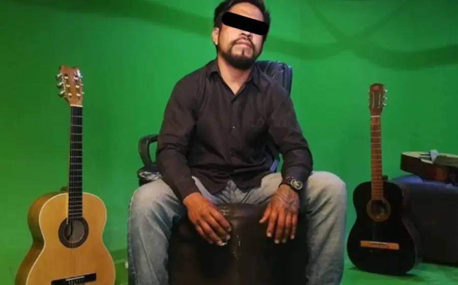 Diego necesita una reconstrucción completa del rostro.