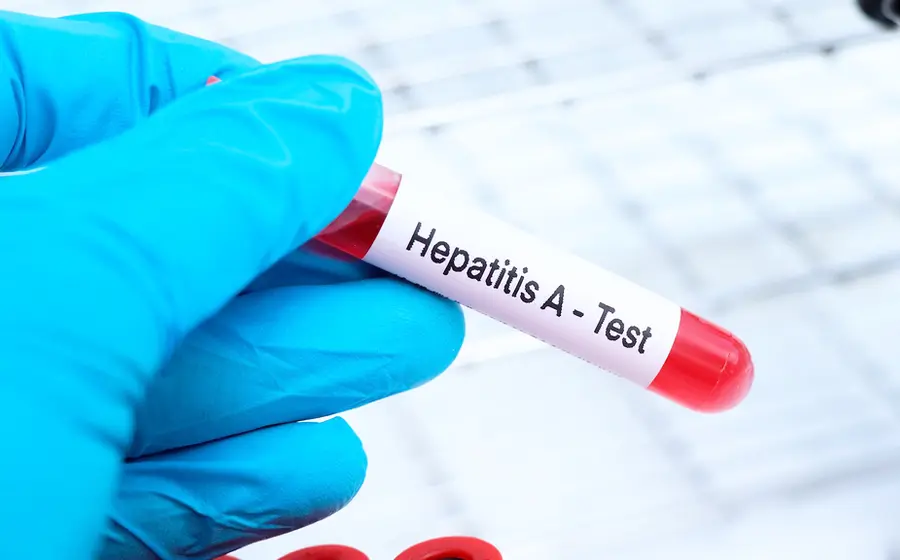 hepatitis