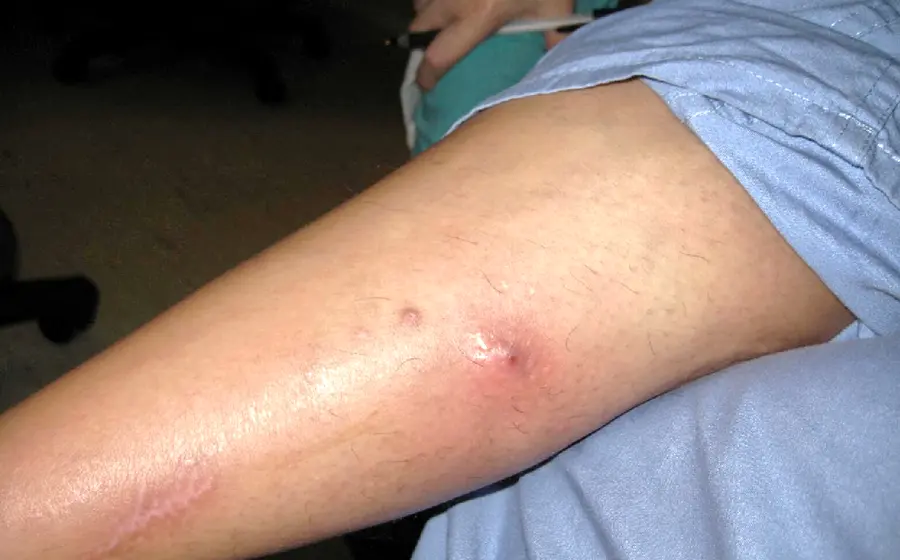 gusano_barrenador_recoemendaciones