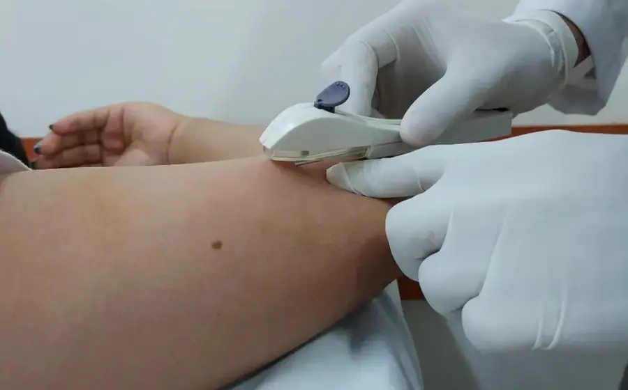 Personal médico del IMSS atiende a una paciente durante la jornada de colocación de implantes subdérmicos, un método anticonceptivo dirigido a mujeres.
