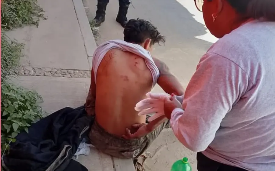 Jesús Ángel, un hombre que muestra las heridas tras ser golpeado por mototaxistas en la agencia municipal de San Martín Mexicápam.