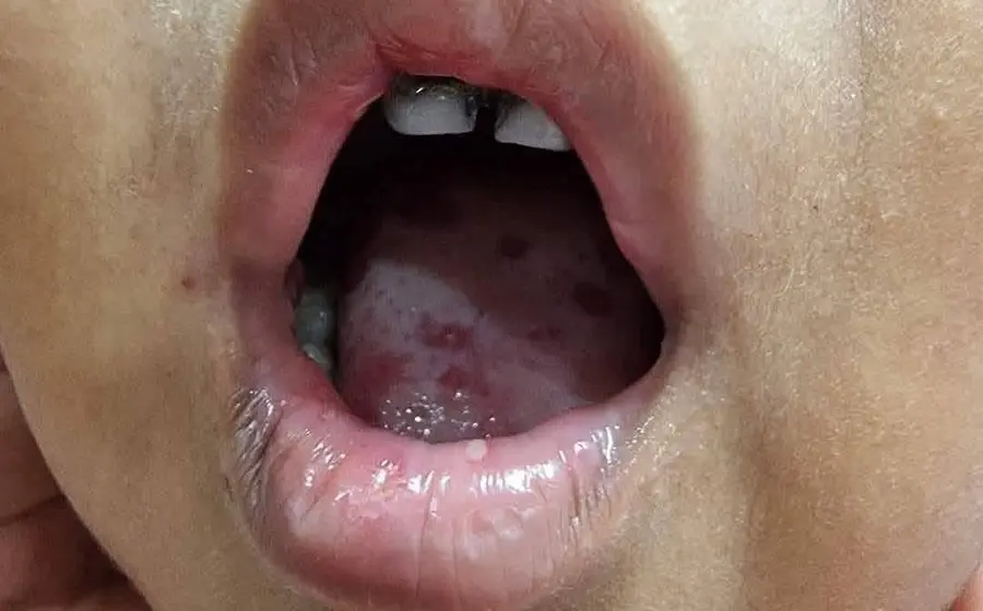  Entre las recomendaciones destaca el lavado frecuente de manos con agua y jabón.