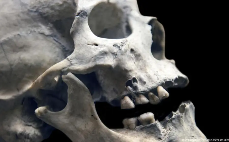 Evidencia arqueológica de una exitosa operación maxilofacial realizada hace 2,500 años, intervención que la paciente sobrevivió y le permitió recuperarse.