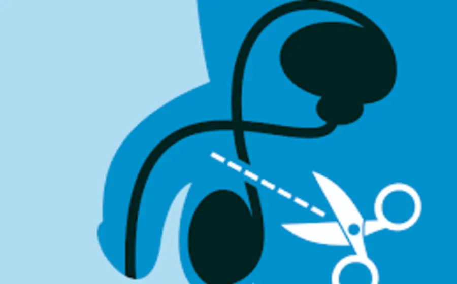 Cada viernes ofrecen vasectomías gratis en unidades médicas del estado.