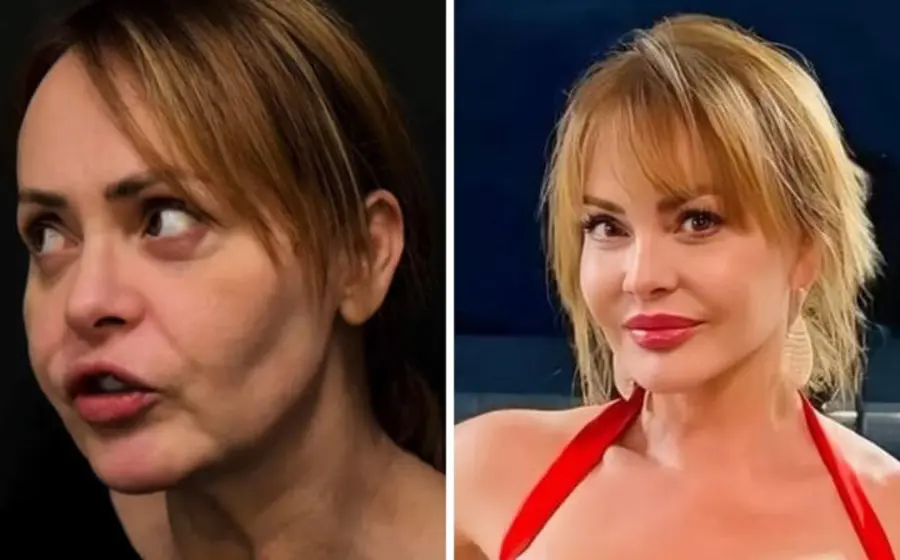 La actriz Gaby Spanic muestra su radical cambio físico después de someterse a una cirugía correctiva en Brasil.
