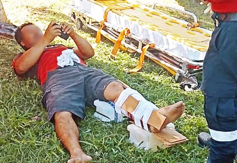 fractura
