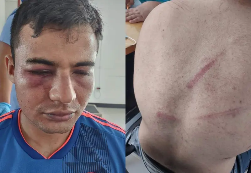 golpeado