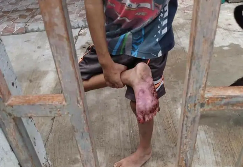Los niños presentan alto grado de desnutrición, deshidratación y diversas lesiones.