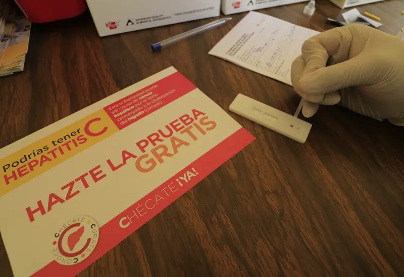 Prueba de hepatitis c