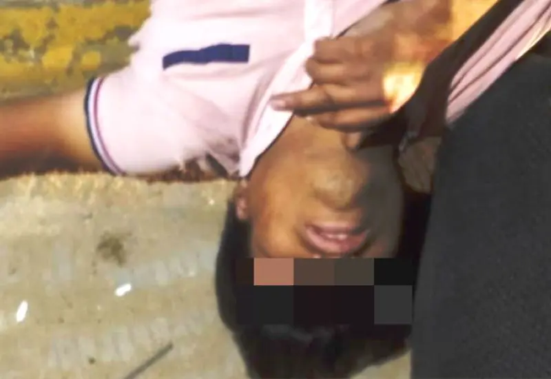 Joven tirado en el piso tras derrapar