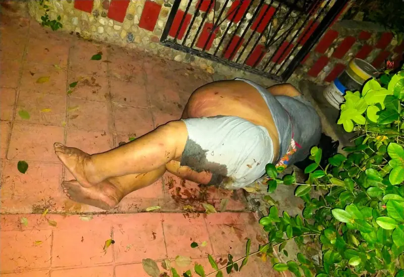 Mujer se resbala y sufre lesiones