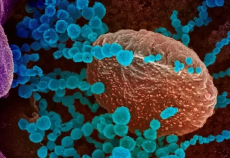 Virus