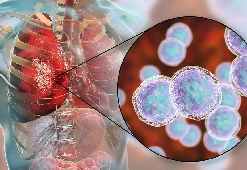 bacterias