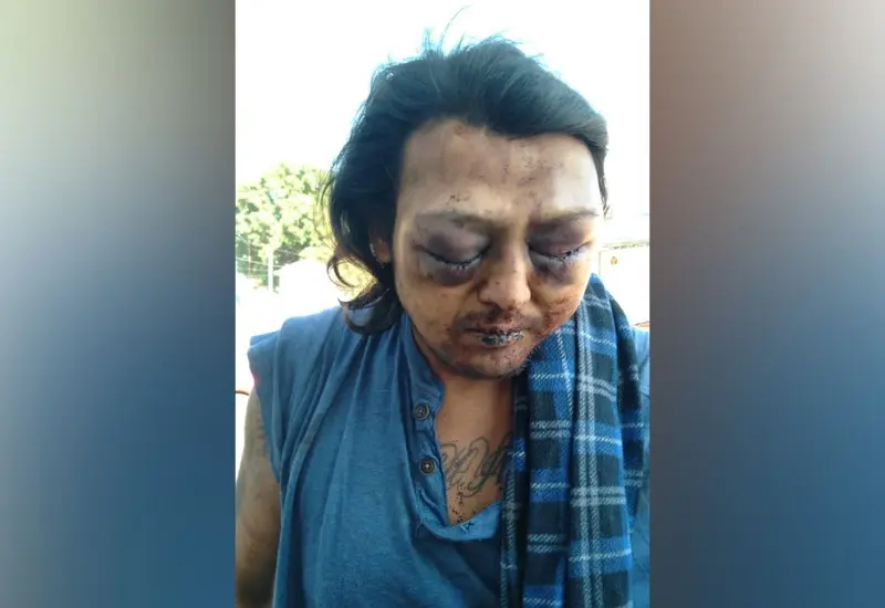 Golpeado en la central