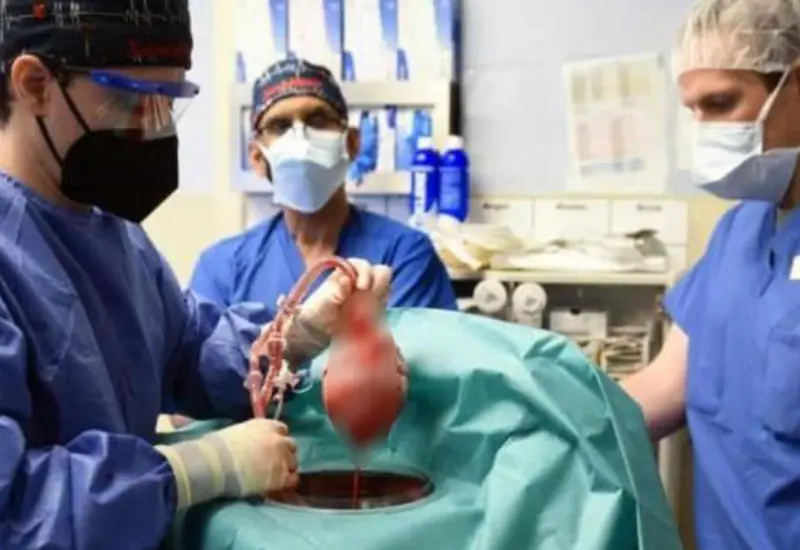 Médicos indicaron que se trata del primer trasplante exitoso de un corazón de cerdo a una persona.