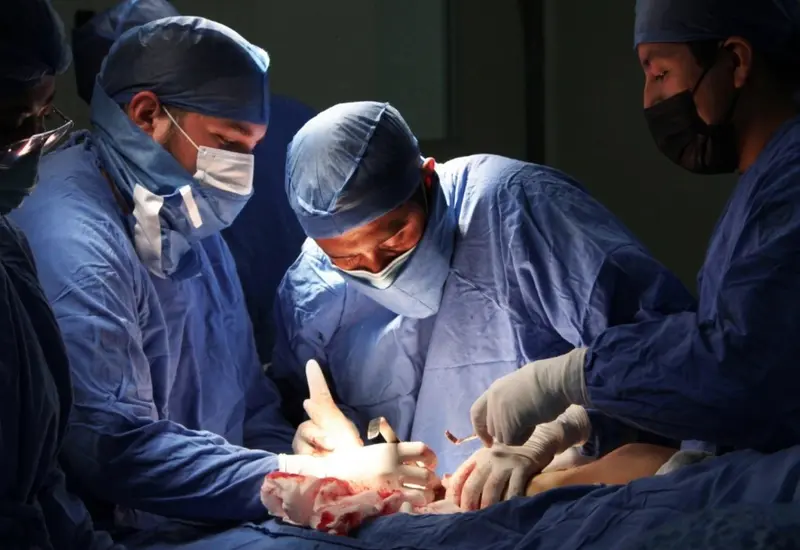 operación_de_transplante